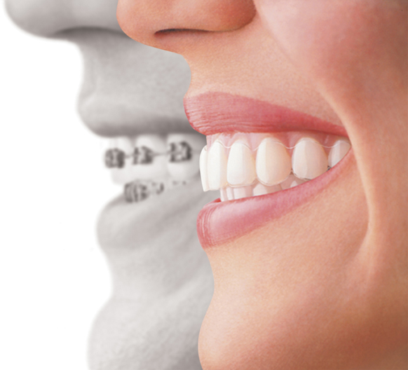 How to Find the Right Cosmetic Dentists Flushing NY